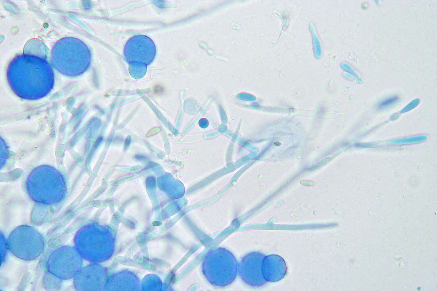 Image of Mycogone rosea Link 1809