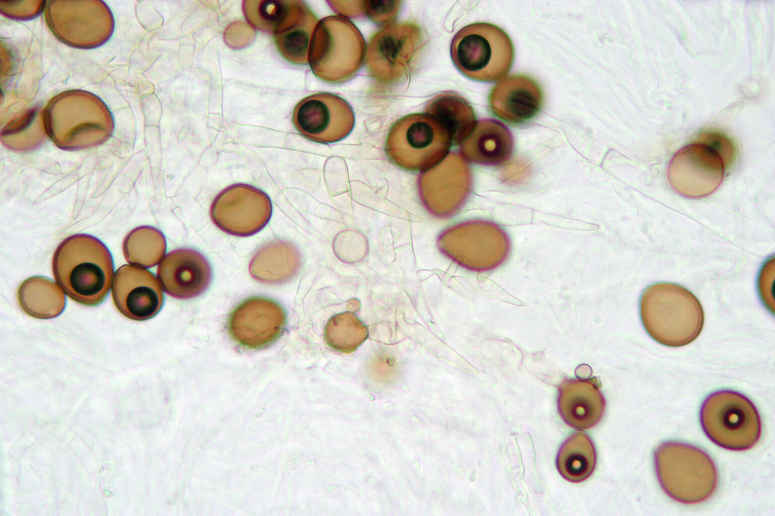 Acremoniella atra (Corda) Sacc. 1886 resmi