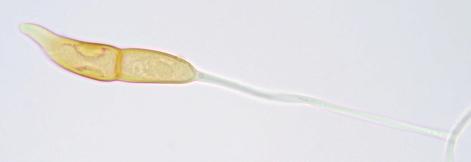 Imagem de Puccinia longicornis Pat. & Har. 1891