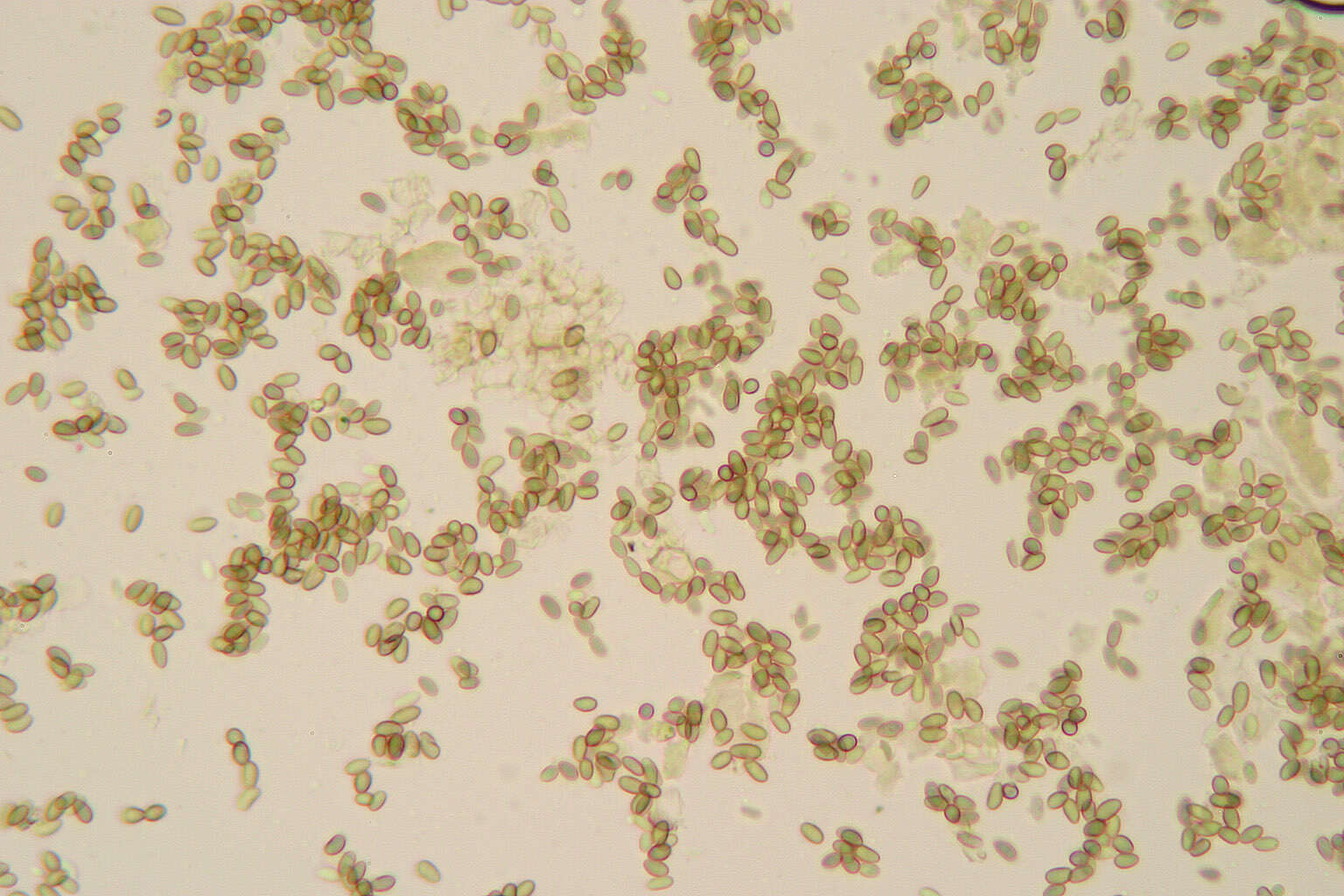 Imagem de Microsphaeropsis