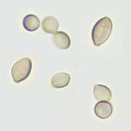 Image of Sordariomycetes