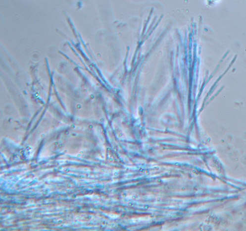 Claussenomyces prasinulus (P. Karst.) Korf & Abawi 1971 resmi