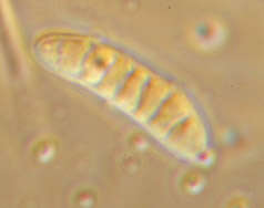 Claussenomyces prasinulus (P. Karst.) Korf & Abawi 1971 resmi