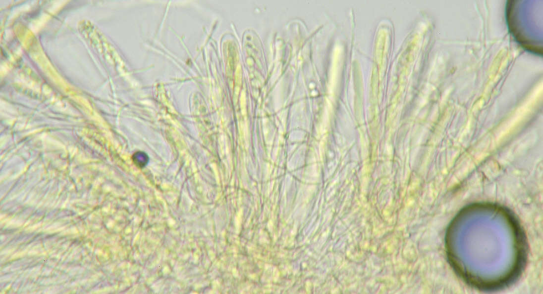 Claussenomyces prasinulus (P. Karst.) Korf & Abawi 1971 resmi