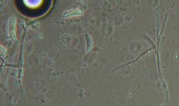 Claussenomyces prasinulus (P. Karst.) Korf & Abawi 1971 resmi