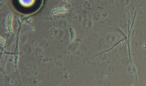 Claussenomyces prasinulus (P. Karst.) Korf & Abawi 1971 resmi