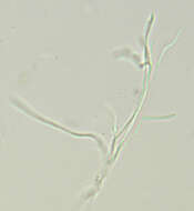 Claussenomyces prasinulus (P. Karst.) Korf & Abawi 1971 resmi