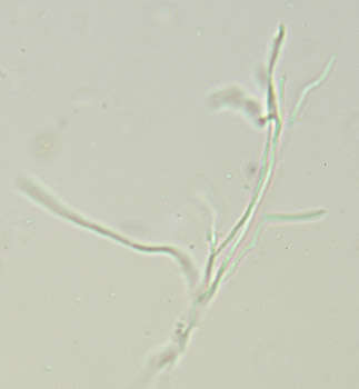 Claussenomyces prasinulus (P. Karst.) Korf & Abawi 1971 resmi