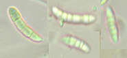 Claussenomyces prasinulus (P. Karst.) Korf & Abawi 1971 resmi