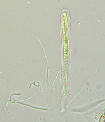 Claussenomyces prasinulus (P. Karst.) Korf & Abawi 1971 resmi