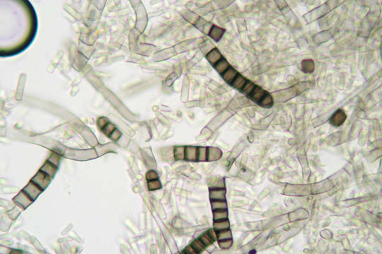 Thielaviopsis resmi