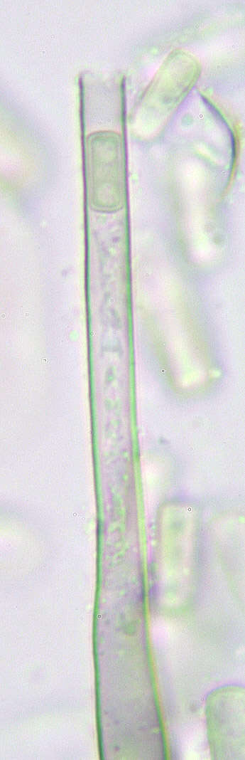 Thielaviopsis resmi