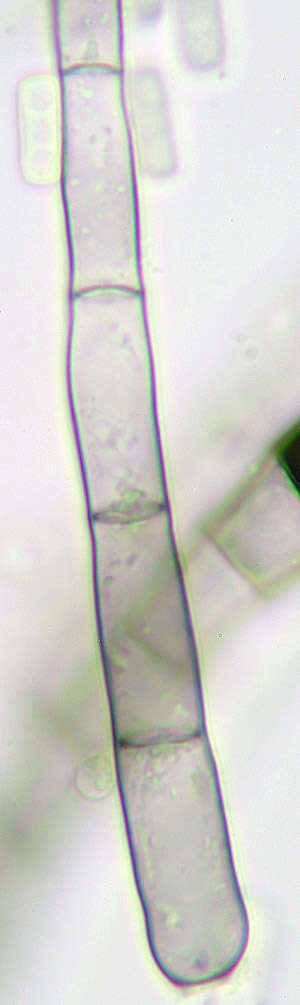 Thielaviopsis resmi