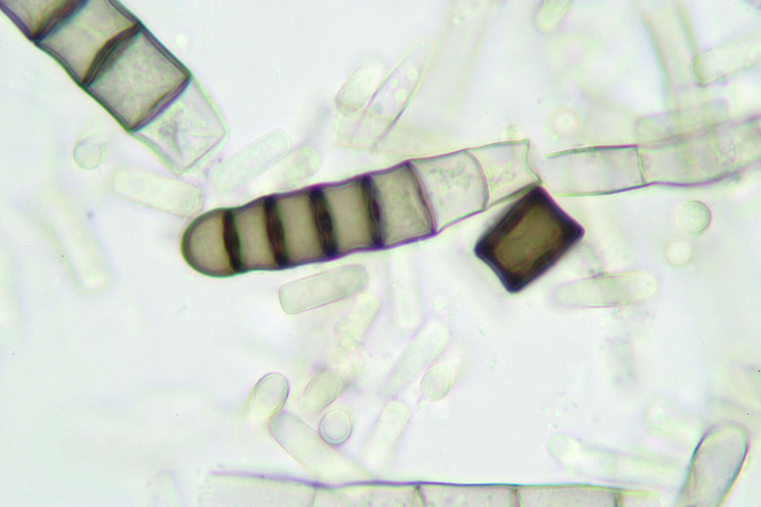 Thielaviopsis resmi