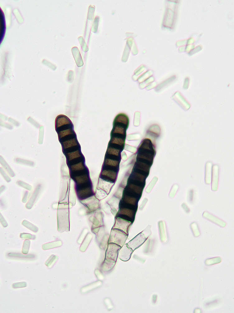 Thielaviopsis resmi