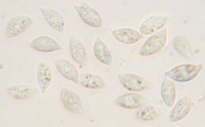 Слика од Rhizomarasmius setosus (Sowerby) Antonín & A. Urb. 2015