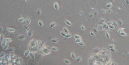 Слика од Rhizomarasmius setosus (Sowerby) Antonín & A. Urb. 2015