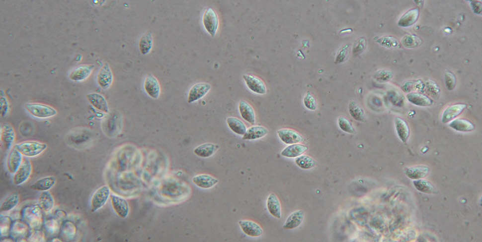 Слика од Rhizomarasmius setosus (Sowerby) Antonín & A. Urb. 2015