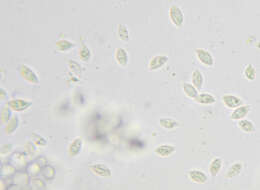 Слика од Rhizomarasmius setosus (Sowerby) Antonín & A. Urb. 2015