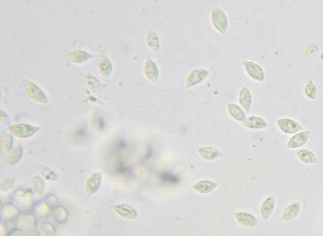 Слика од Rhizomarasmius setosus (Sowerby) Antonín & A. Urb. 2015