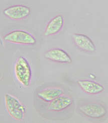 Слика од Rhizomarasmius setosus (Sowerby) Antonín & A. Urb. 2015