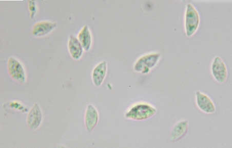 Слика од Rhizomarasmius setosus (Sowerby) Antonín & A. Urb. 2015