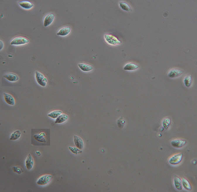 Слика од Rhizomarasmius setosus (Sowerby) Antonín & A. Urb. 2015