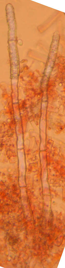 Image of Gyrophanopsis polonensis (Bres.) Stalpers & P. K. Buchanan 1991