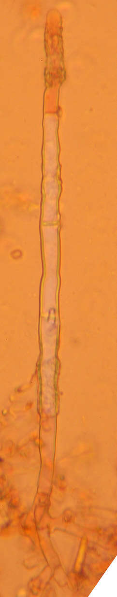 Image of Gyrophanopsis polonensis (Bres.) Stalpers & P. K. Buchanan 1991
