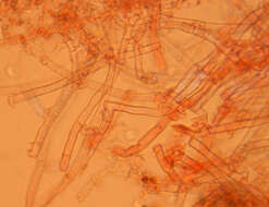 Image of Gyrophanopsis polonensis (Bres.) Stalpers & P. K. Buchanan 1991