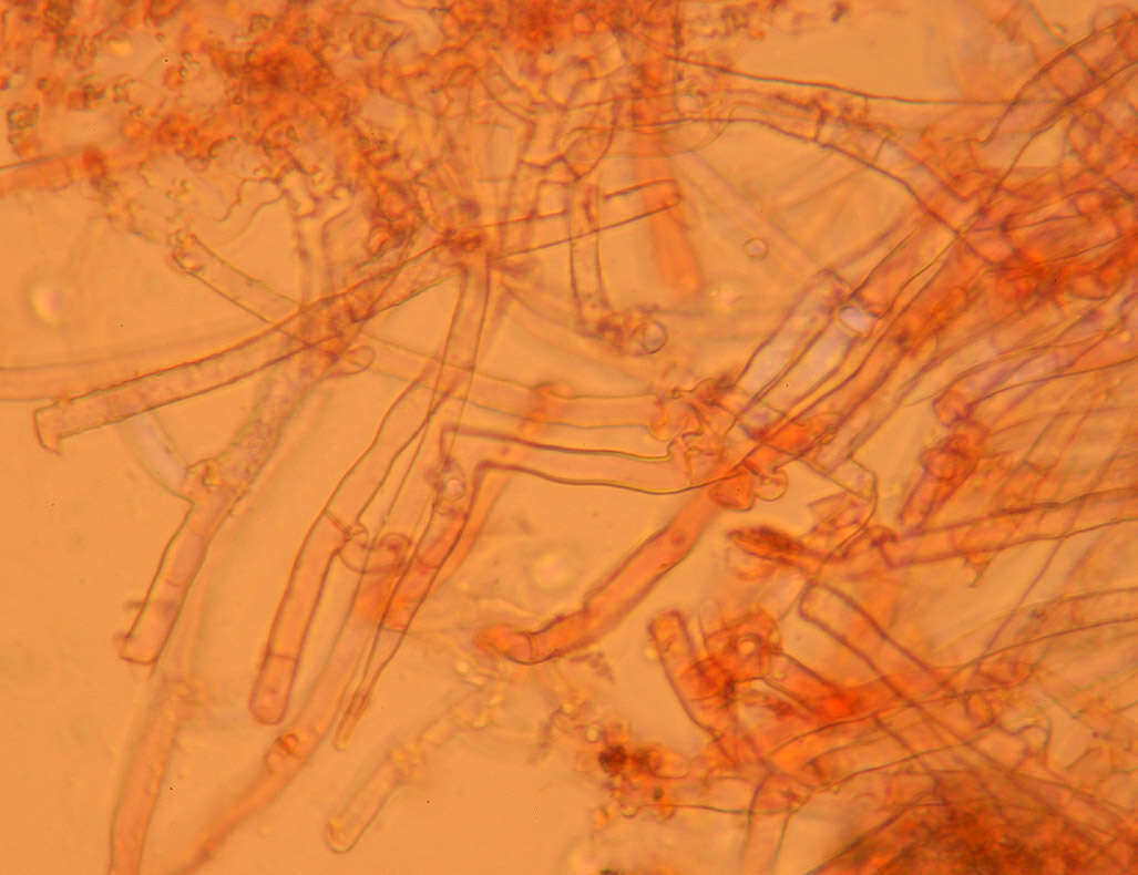 Image of Gyrophanopsis polonensis (Bres.) Stalpers & P. K. Buchanan 1991