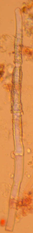 Image of Gyrophanopsis polonensis (Bres.) Stalpers & P. K. Buchanan 1991