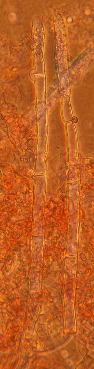 Image of Gyrophanopsis polonensis (Bres.) Stalpers & P. K. Buchanan 1991