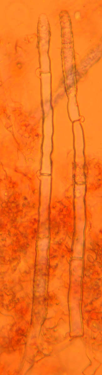 Image of Gyrophanopsis polonensis (Bres.) Stalpers & P. K. Buchanan 1991