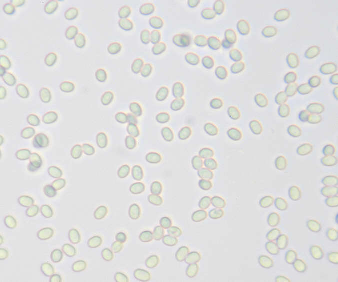 Image of Gyrophanopsis polonensis (Bres.) Stalpers & P. K. Buchanan 1991