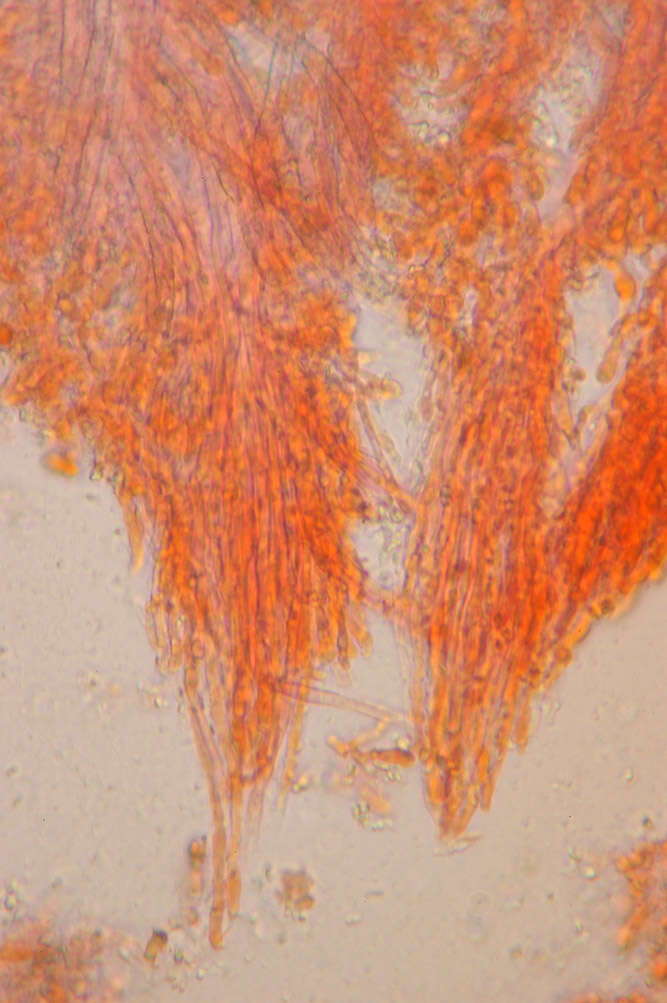 Imagem de Mycoaciella bispora (Stalpers) J. Erikss. & Ryvarden 1978