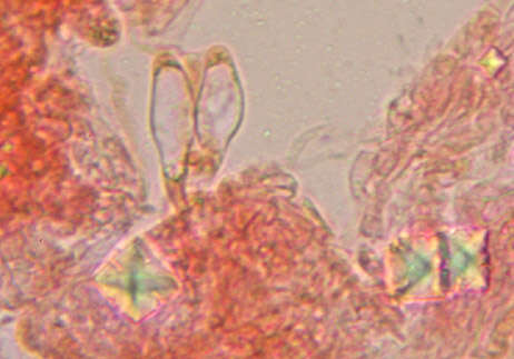 Image of Radulomyces confluens (Fr.) M. P. Christ. 1960