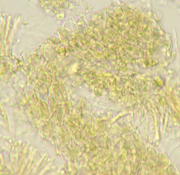 Image of Orbiliomycetes
