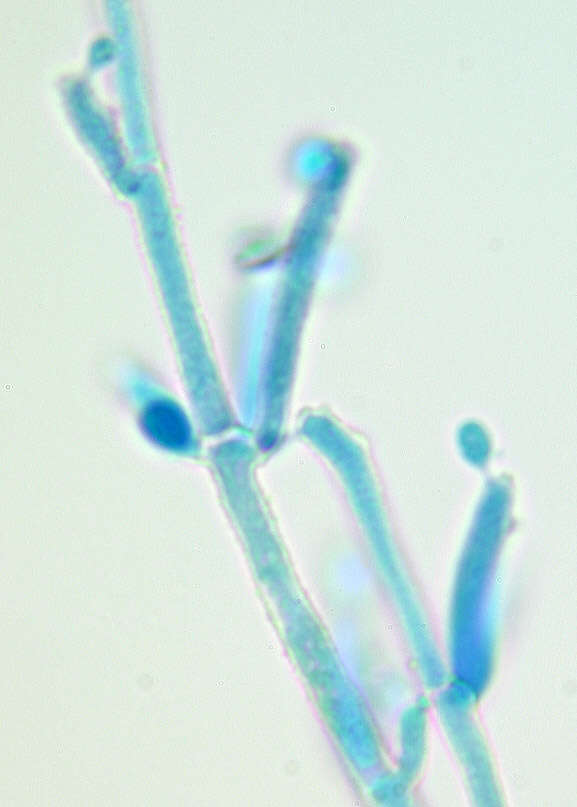 Image of Calcarisporium arbuscula Preuss 1851