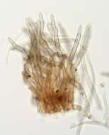 Image of Pseudocercospora depazeoides (Desm.) U. Braun & Crous 2015