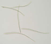 Image of Pseudocercospora depazeoides (Desm.) U. Braun & Crous 2015