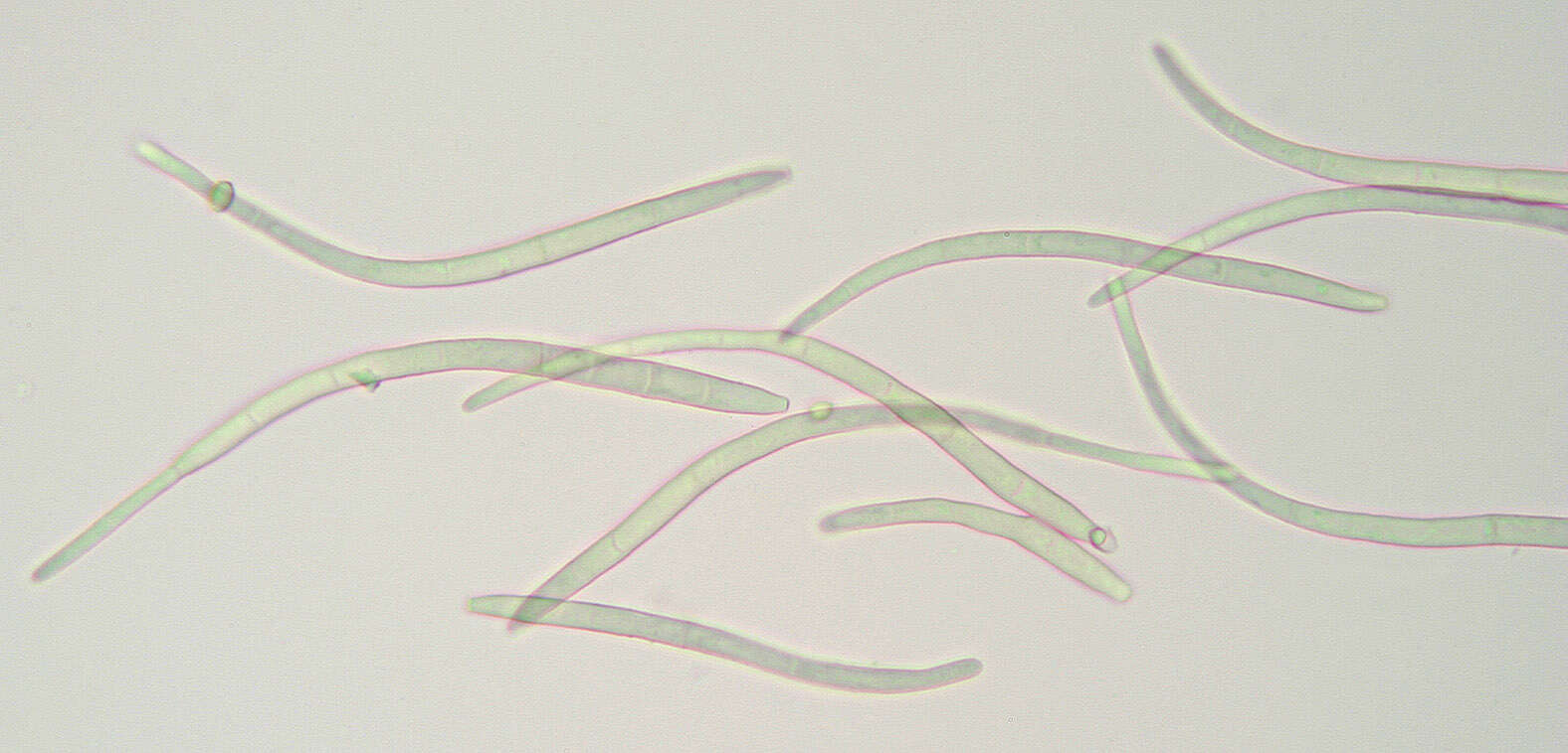 Image of Pseudocercospora depazeoides (Desm.) U. Braun & Crous 2015