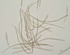 Image of Pseudocercospora depazeoides (Desm.) U. Braun & Crous 2015