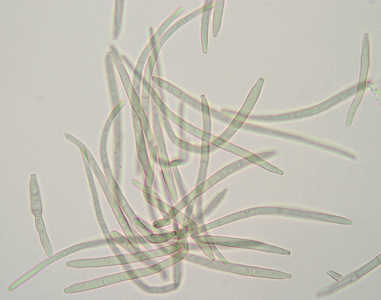 Image of Pseudocercospora depazeoides (Desm.) U. Braun & Crous 2015