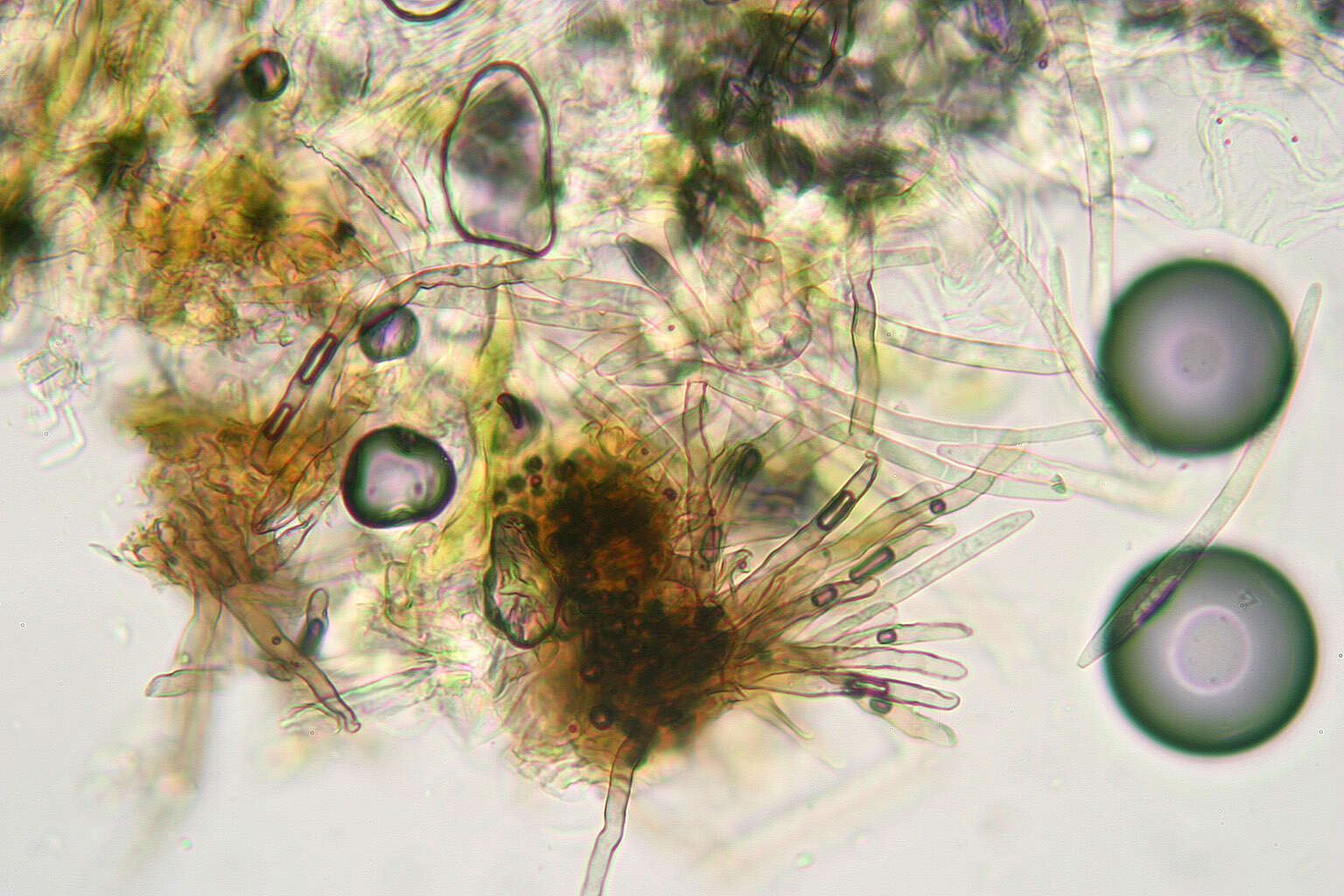 Image of Pseudocercospora depazeoides (Desm.) U. Braun & Crous 2015