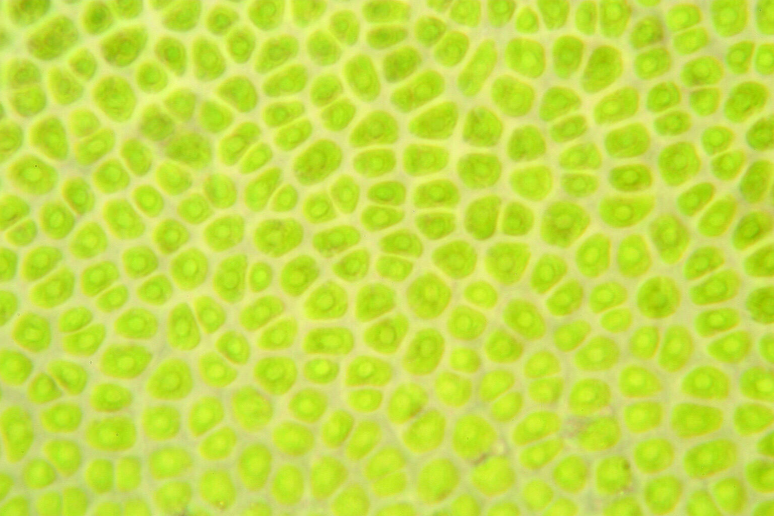 Image of Blidingia minima