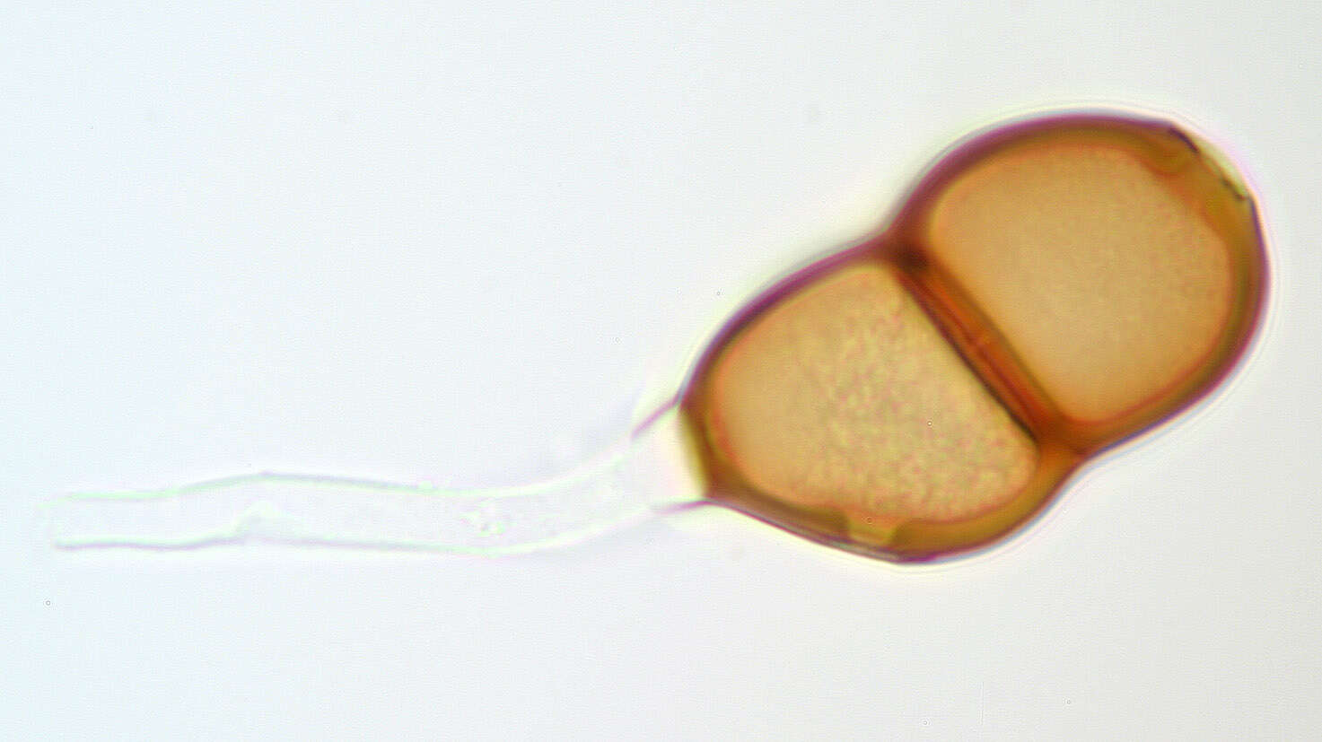 Image de Puccinia chaerophylli Purton 1821