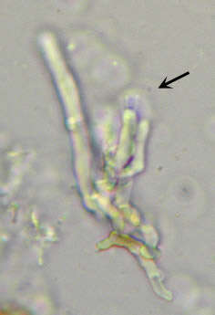 Image de Hyphodontia pallidula (Bres.) J. Erikss. 1958