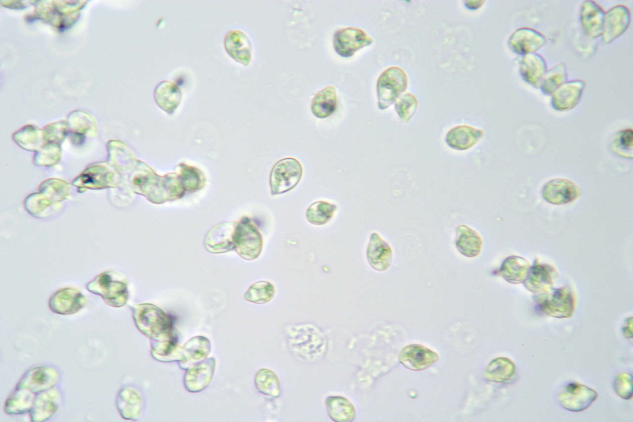 Image de Rhizochaete radicata (Henn.) Gresl., Nakasone & Rajchenb. 2004