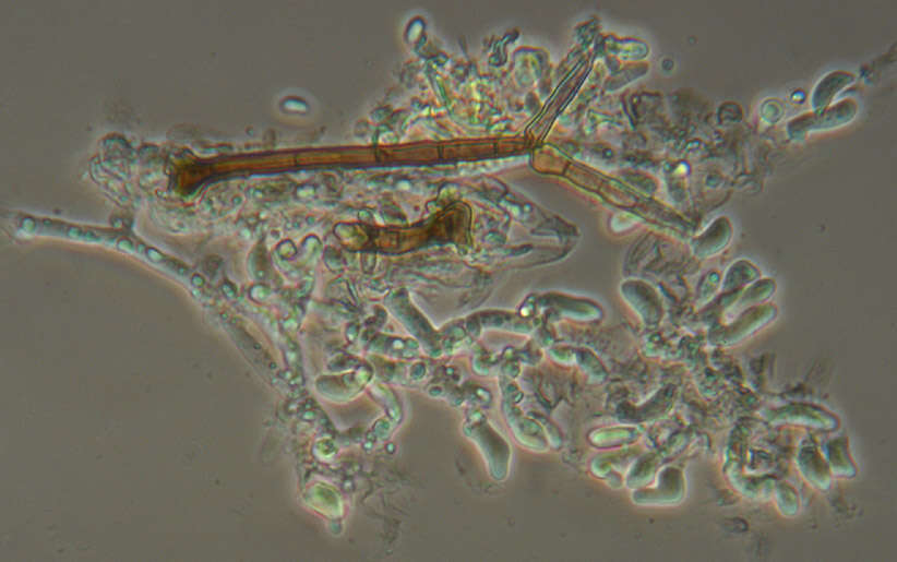 Botryobasidium subcoronatum (Höhn. & Litsch.) Donk 1931 resmi